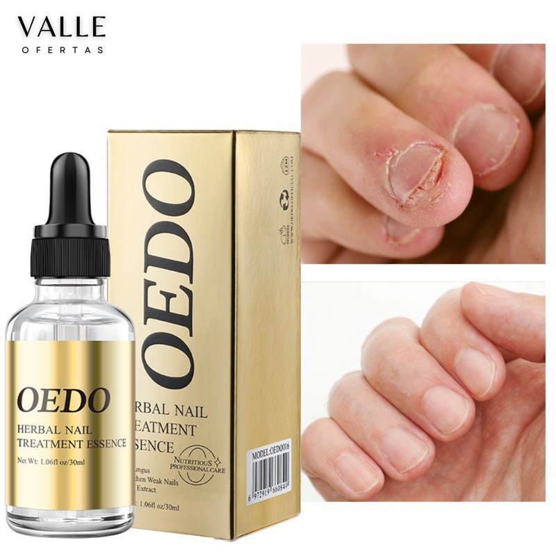 Óleo para Unhas Anti Fungos [FRETE GRÁTIS]